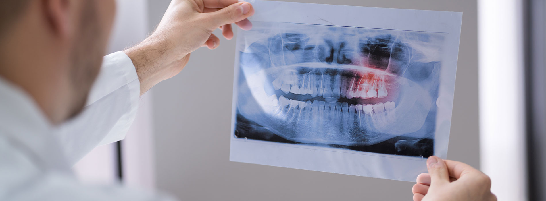 An alternative text description for the image   A medical professional examining an X-ray of a patient s teeth, with the radiograph displayed on a stand.